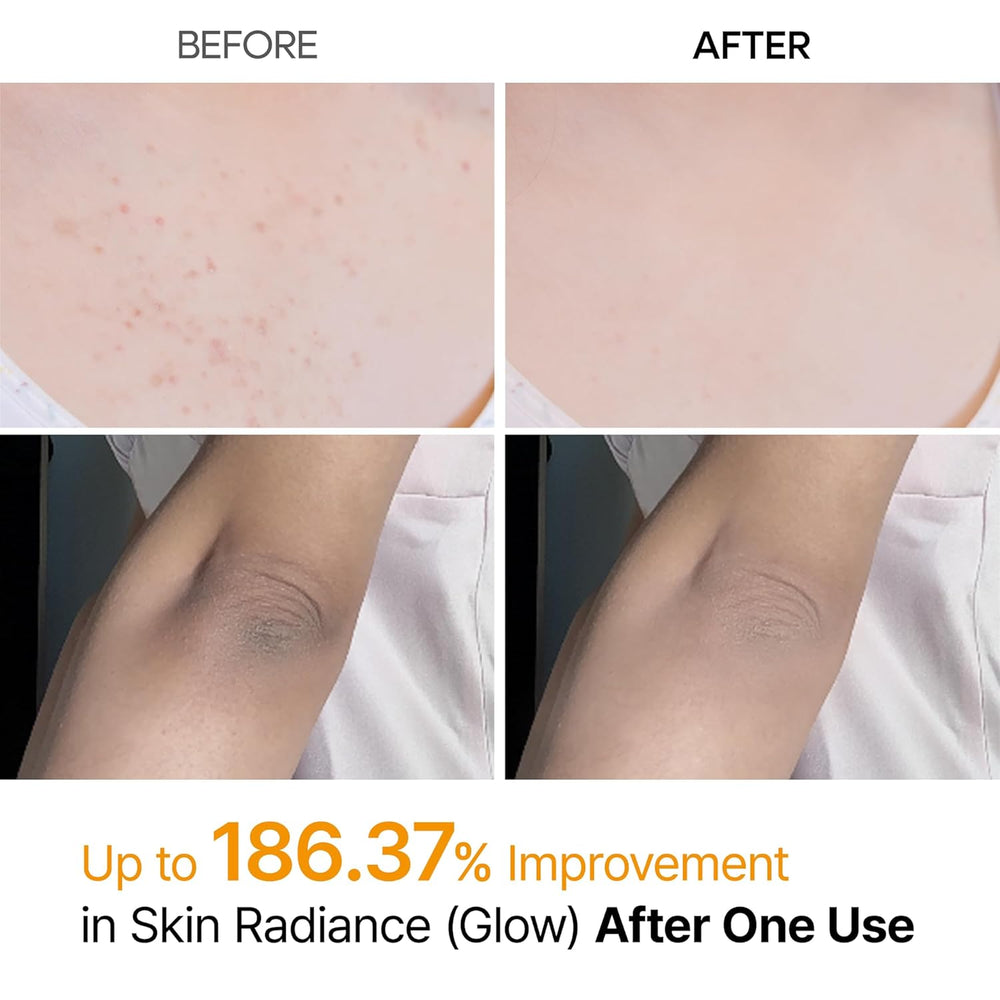Dr.Melaxin -  Kojic Acid Spray
