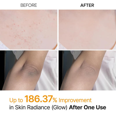 Dr.Melaxin -  Kojic Acid Spray
